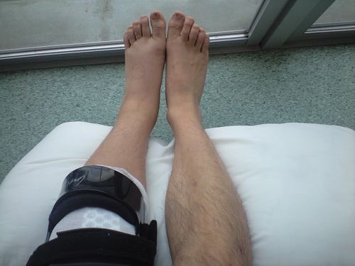 左足が腫れてます〜